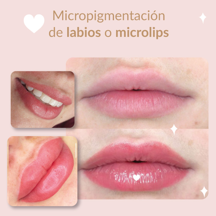 Labios irresistibles: Micropigmentación para unos labios perfectos – Conoce Todo Sobre este Procedimiento